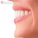Nha Khoa Denta - Lê Văn Sỹ